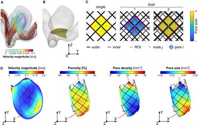 Association Between Aneurysmal Haemodynamics and Device Microstructural Characteristics After Flow-Diversion Treatments With Dual Stents of Different Sizes: A Numerical Study